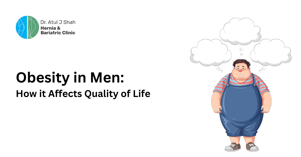 Obesity in Men: How it Affects Quality of Life