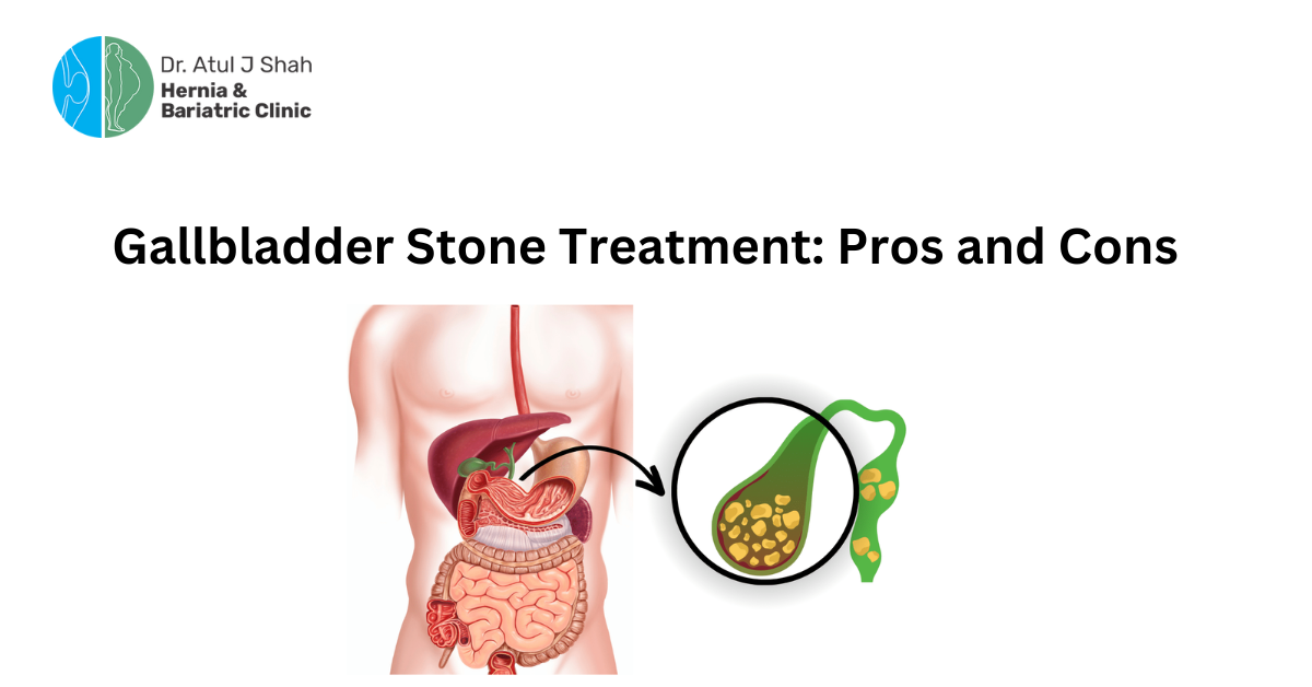 Gallbladder Stone Treatment: Pros and Cons