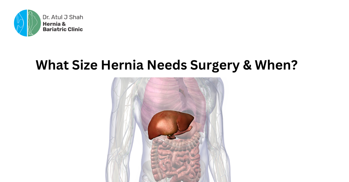 What Size Hernia Needs Surgery & When?