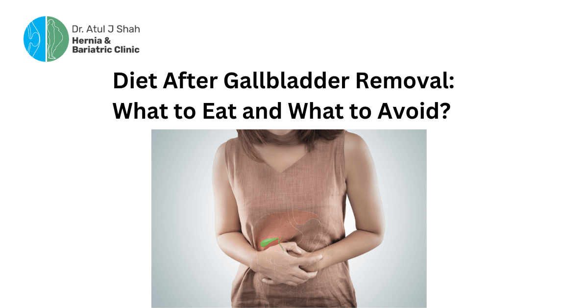 Diet After Gallbladder Removal: What to Eat and What to Avoid?