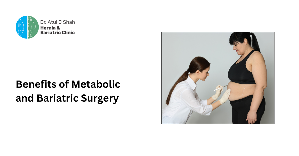 Benefits of Metabolic and Bariatric Surgery