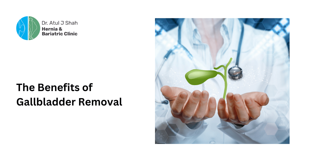 Benefits of Gallbladder Removal