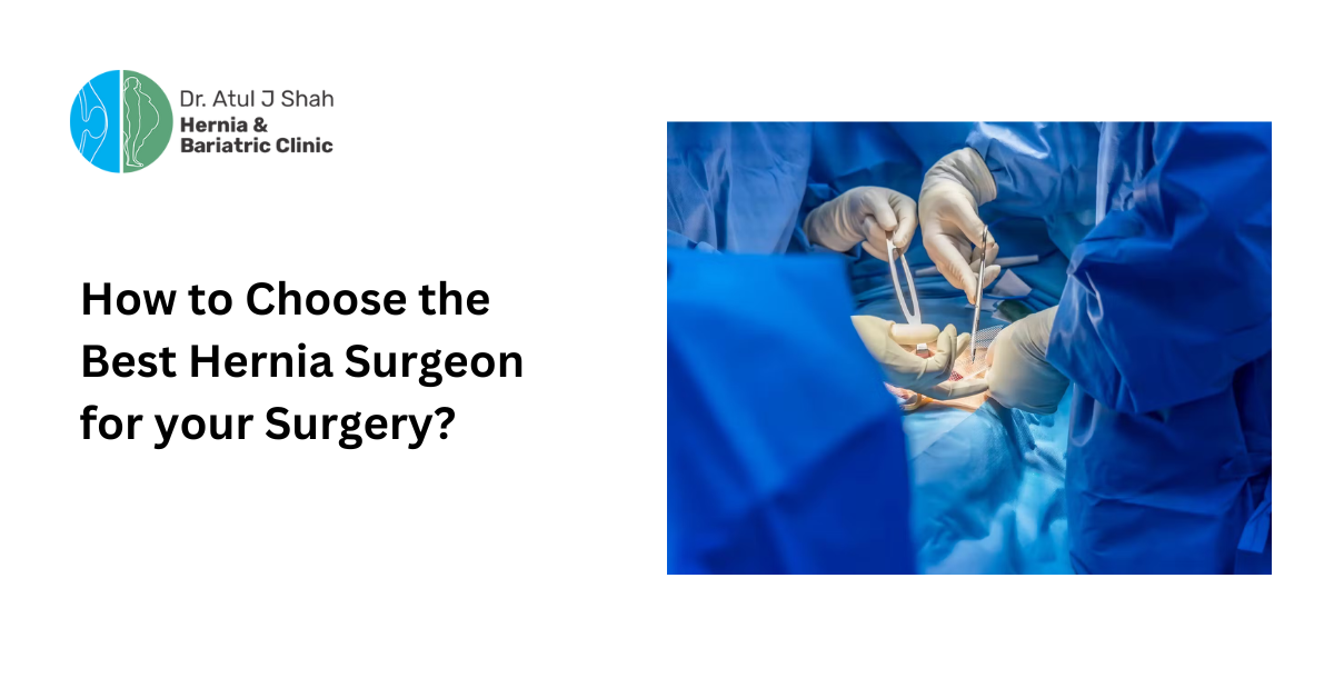 How to Choose the Best Hernia Surgeon for your Surgery?