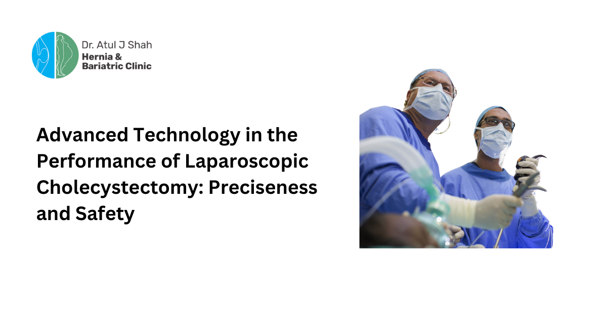 Advanced Technology in the Performance of Laparoscopic Cholecystectomy: Preciseness and Safety