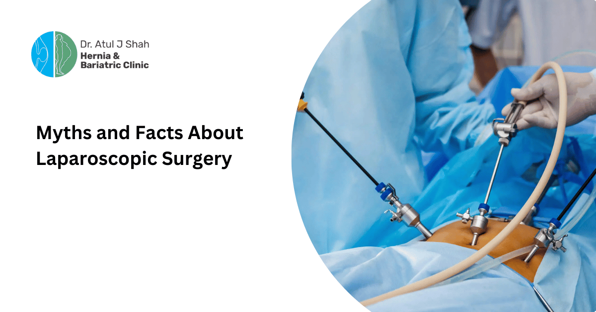 Myths and Facts About Laparoscopic Surgery